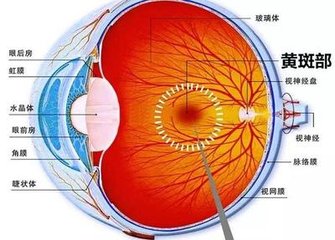 黃斑變性是怎么回事？黃斑變性的方法？
