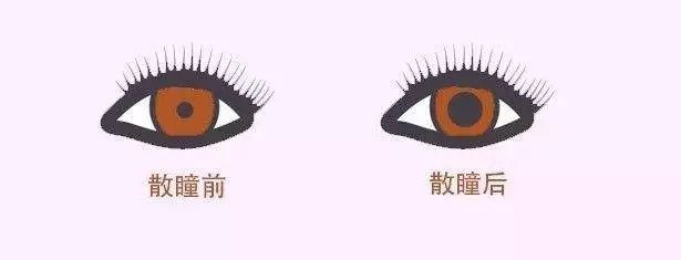 配眼鏡還散瞳，散瞳對眼睛有傷害嗎