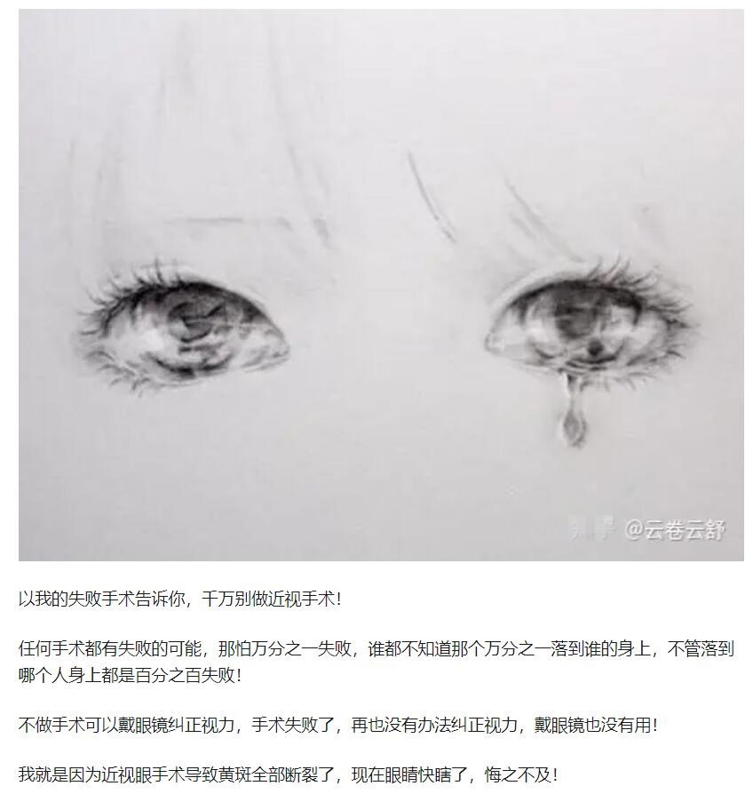 教你，怎樣去了解近視手術(shù)  